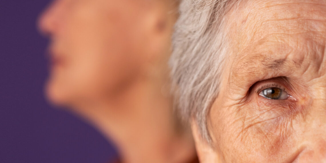 Afasia: cuando las palabras se escapan