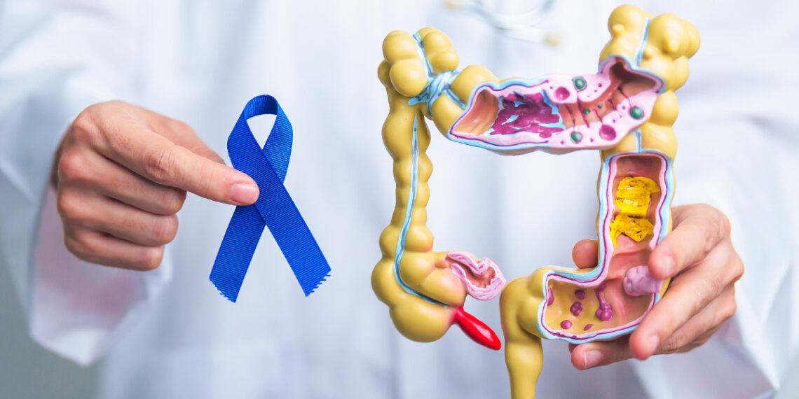 Identifican una de las claves de la alta agresividad del cáncer de páncreas