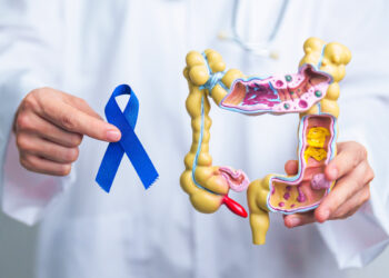 Identifican una de las claves de la alta agresividad del cáncer de páncreas