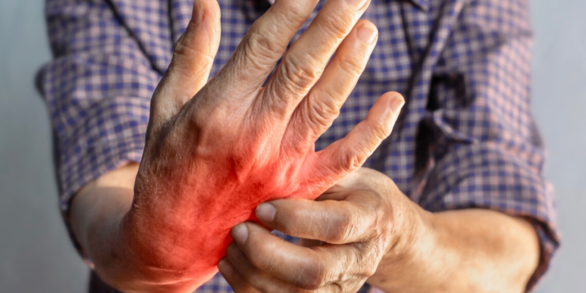 Cuida tus articulaciones, más allá de la edad