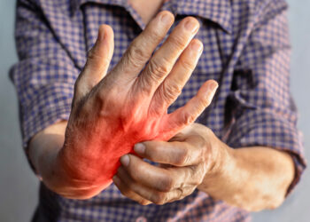 Cuida tus articulaciones, más allá de la edad