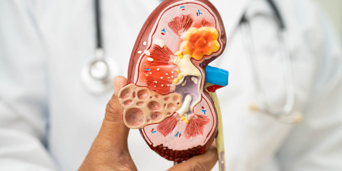 Riñones 101: lo que toda persona debe saber