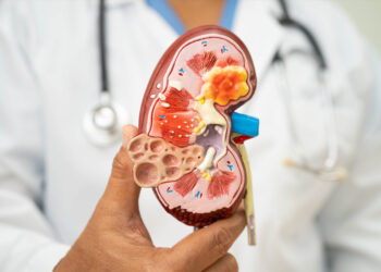 Riñones 101: lo que toda persona debe saber