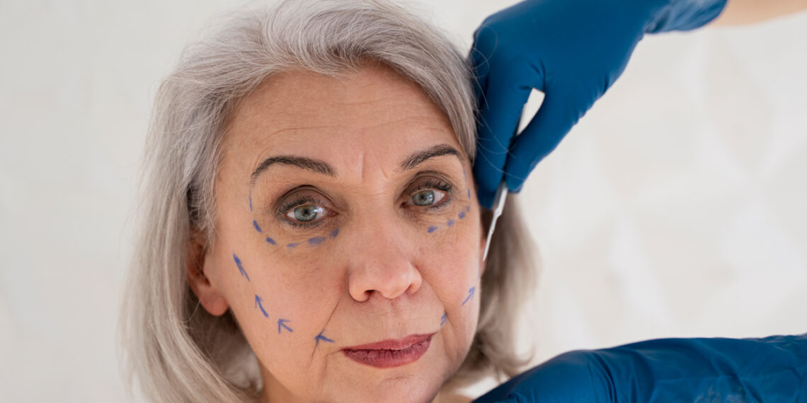 Rellenos dérmicos ayudan a mejorar la piel y el bienestar en adultos mayores