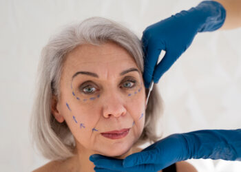 Rellenos dérmicos ayudan a mejorar la piel y el bienestar en adultos mayores