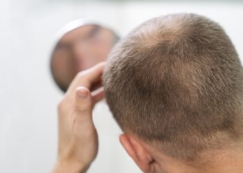 La terapia celular abre una nueva vía para acabar con la calvicie