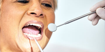 La lengua como indicador clave de la salud general y sistémica