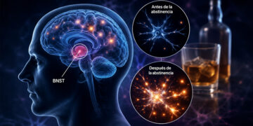 Dejar el alcohol también cambia el cerebro y podría ayudar a entender por qué algunas personas recaen